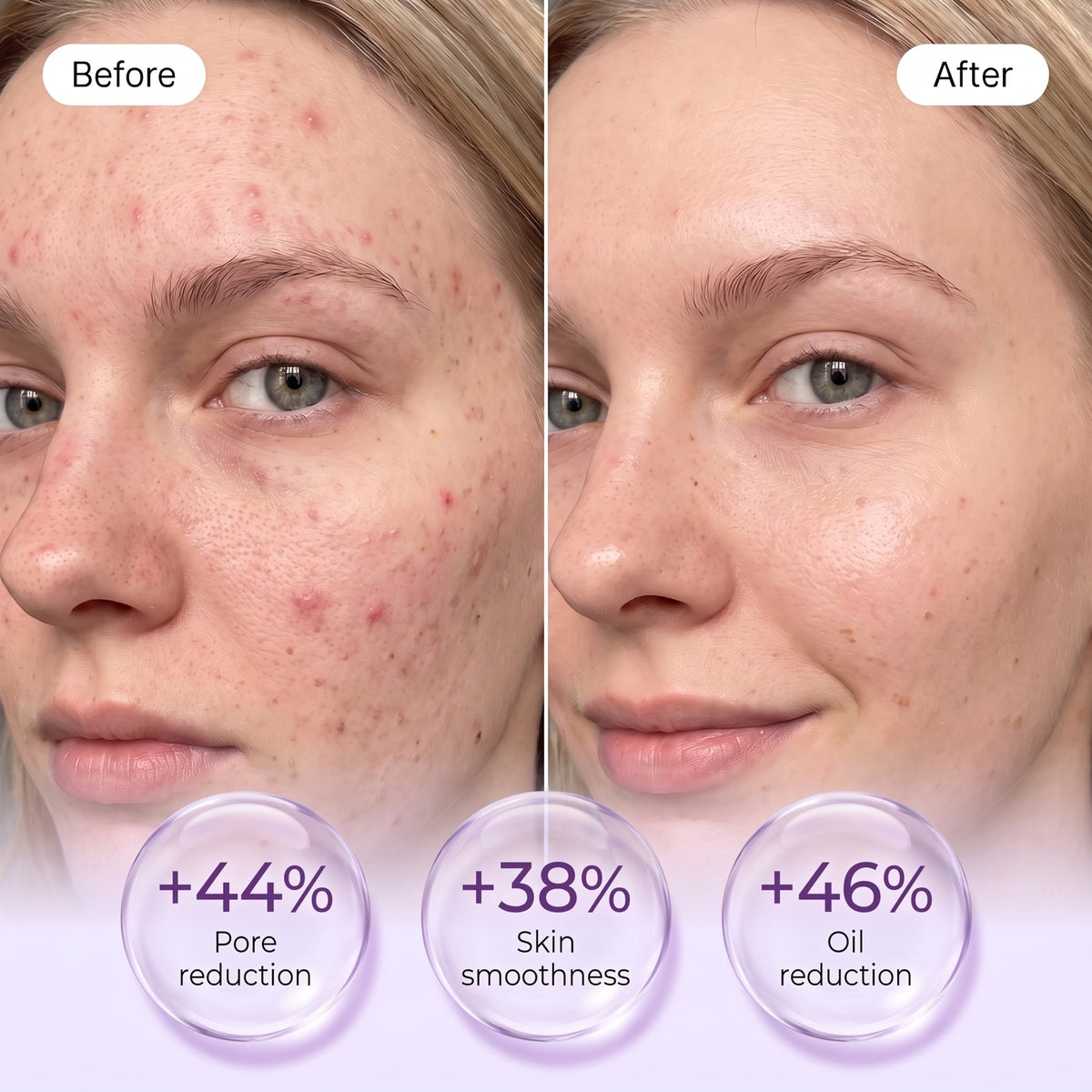 Zero Pore Pads