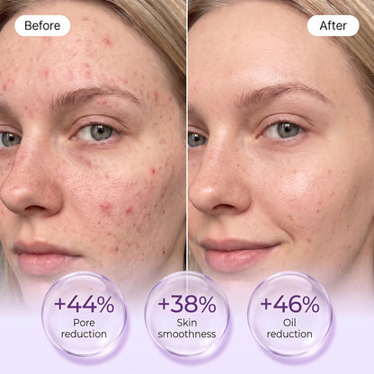 Zero Pore Pads